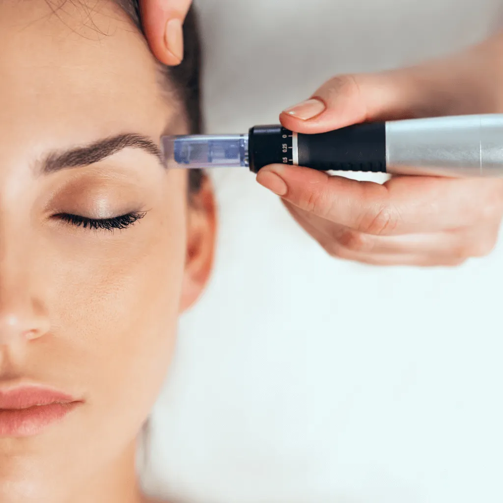 dermapen